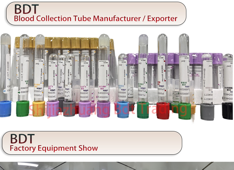 edta plasma separator tube