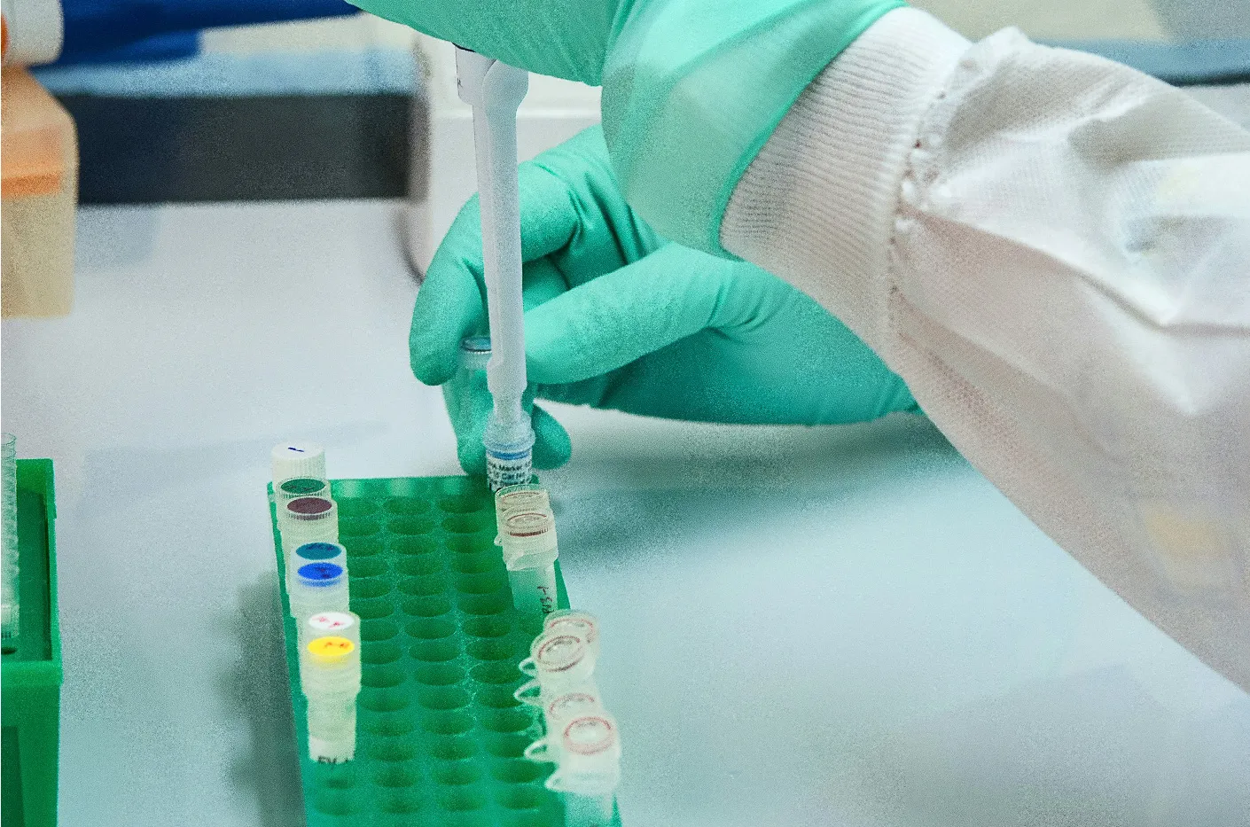 hiv test kit wholesale