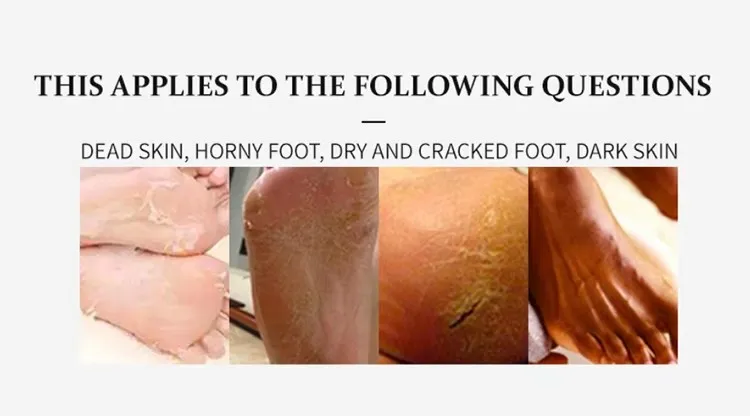 Read More About supplies for foot spa