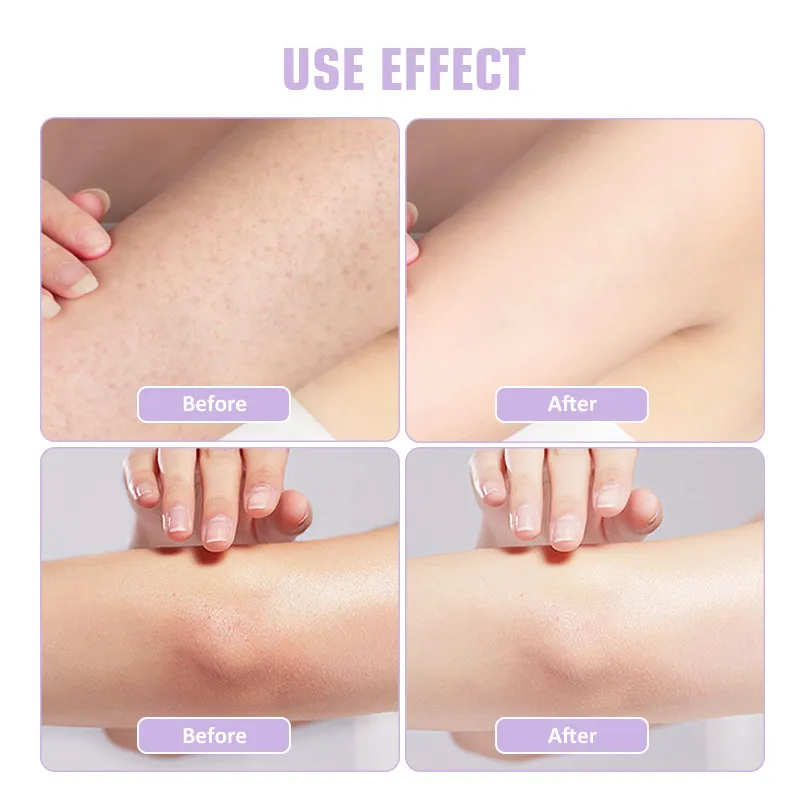 Private Label Brown Sugar Tumeric Coffee Himalayan Salt Charcoal Coconut Bodyscrub Set Face Exfoliating Whitening Body Scrub