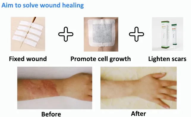 Comprehensive Guide To Wound Care Products