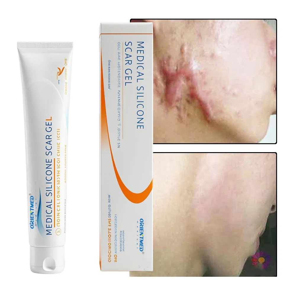 Medical Scar Removal gel 45g