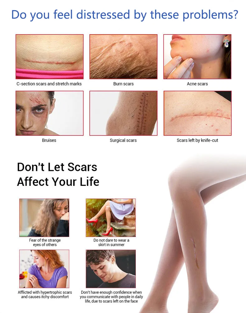 Medical Scar Removal gel 45g