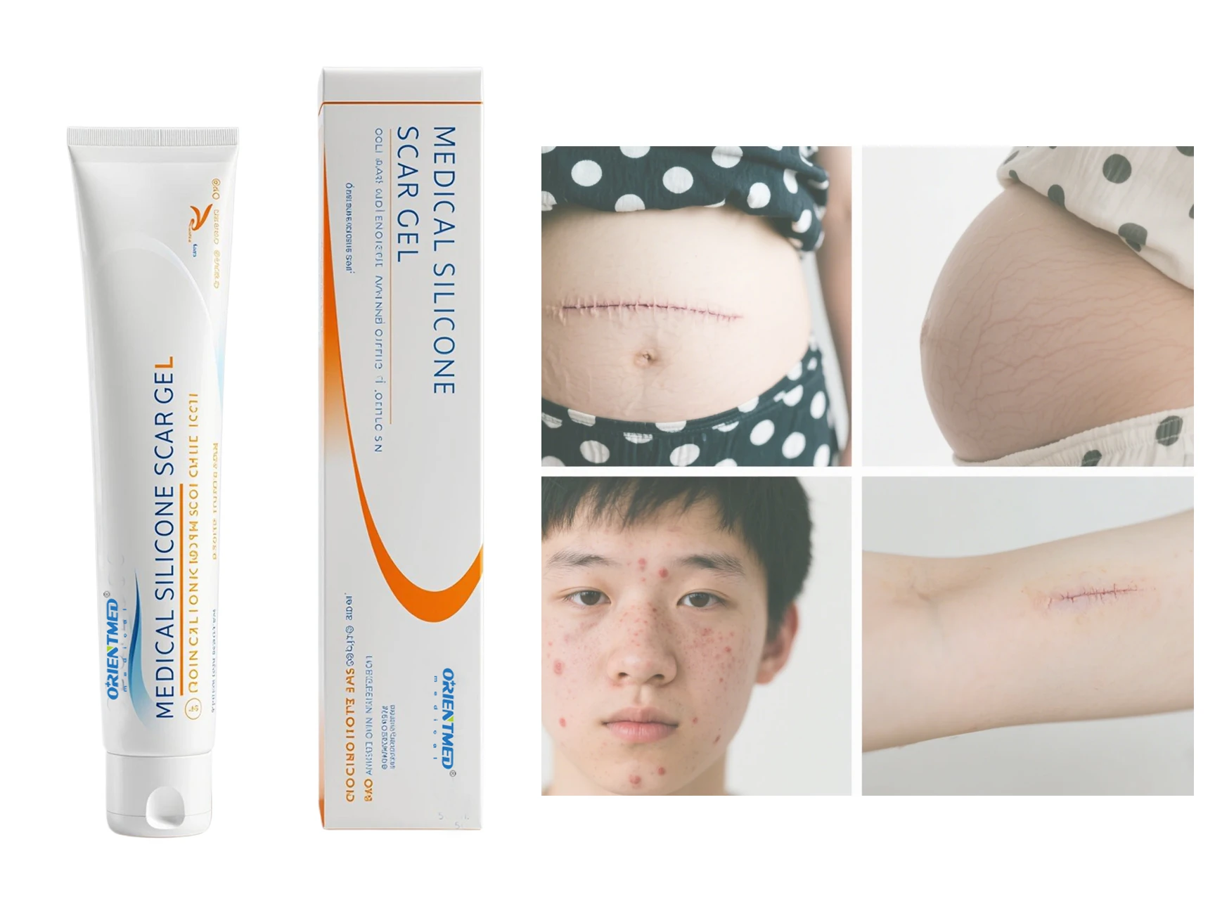https://images.exportstart.com/images/a1324/scar-removal-cream-895.webp