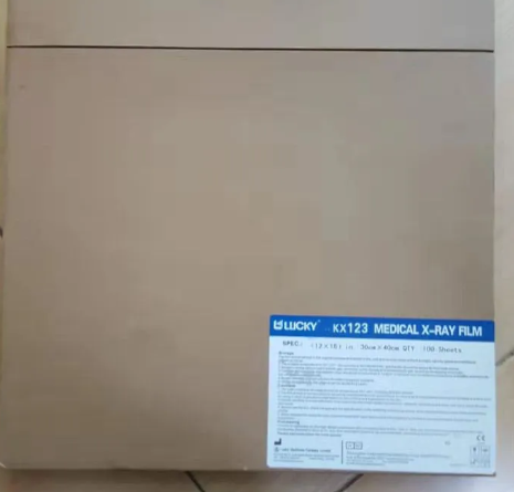 X Ray Film Printing in Pediatric Radiology