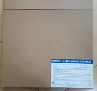 X Ray Film Printing in Pediatric Radiology