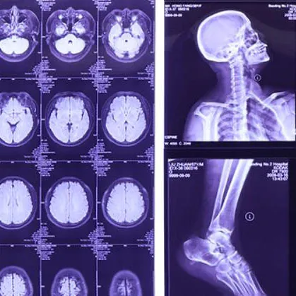 Dry Medical Film: DICOM-Ready, High-Res & Chemical-Free?