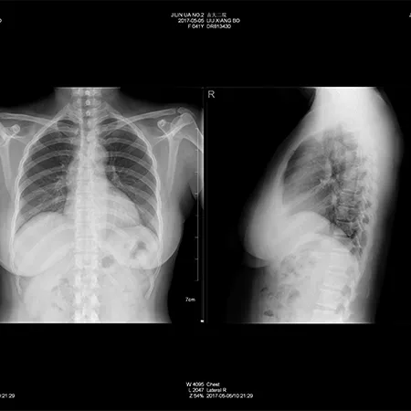 Medical X-Ray Imaging