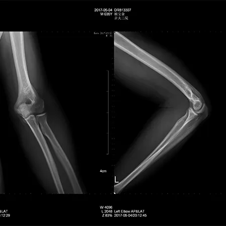 Medical X-Ray Imaging