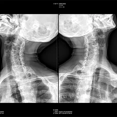 Medical X-Ray Imaging