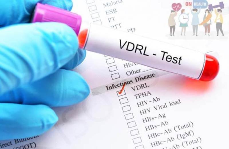 wholesale syphilis at home test kit supplier