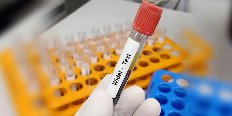 virus sampling extraction tube