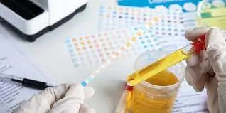 wholesale fobt test price manufacturer